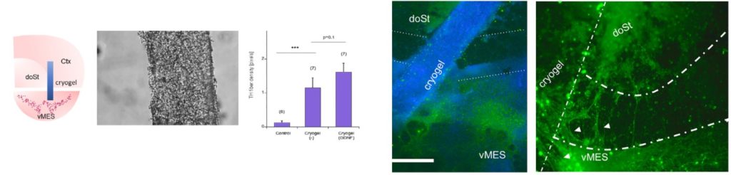 Ex vivo tissue slice culture model of Parkinson's disease